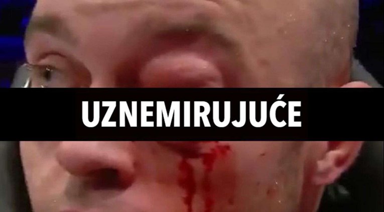 VIDEO Bellatorov borac dobio koljenom u glavu pa zaradio ozbiljnu ozljedu oka