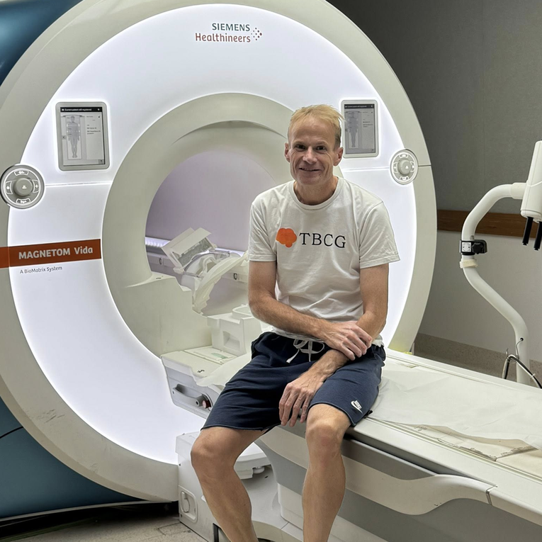 Umro australski doktor koji se 2023. podvrgnuo eksperimentalnom liječenju tumora
