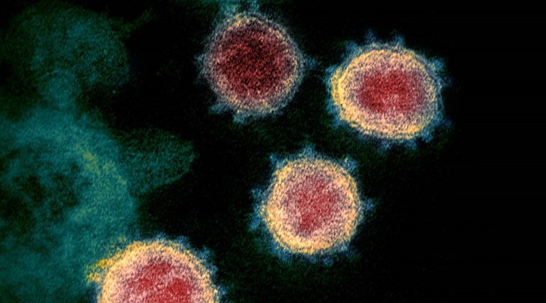 Guardian: Postoji više razloga zašto covid neće biti kao gripa
