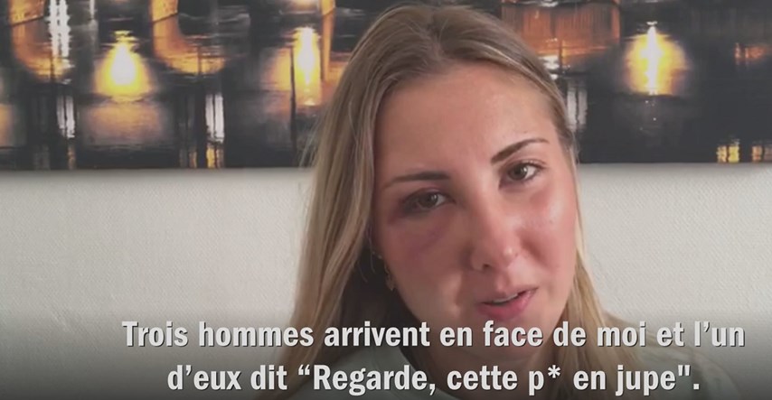 Djevojku u Francuskoj udarili šakom u glavu jer je nosila suknju na ulici