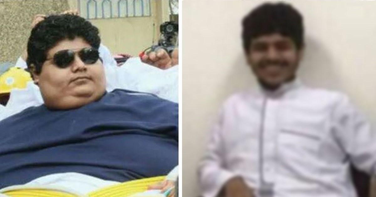 Bivši najteži tinejdžer danas je neprepoznatljiv, skinuo je nevjerojatnih 546 kg