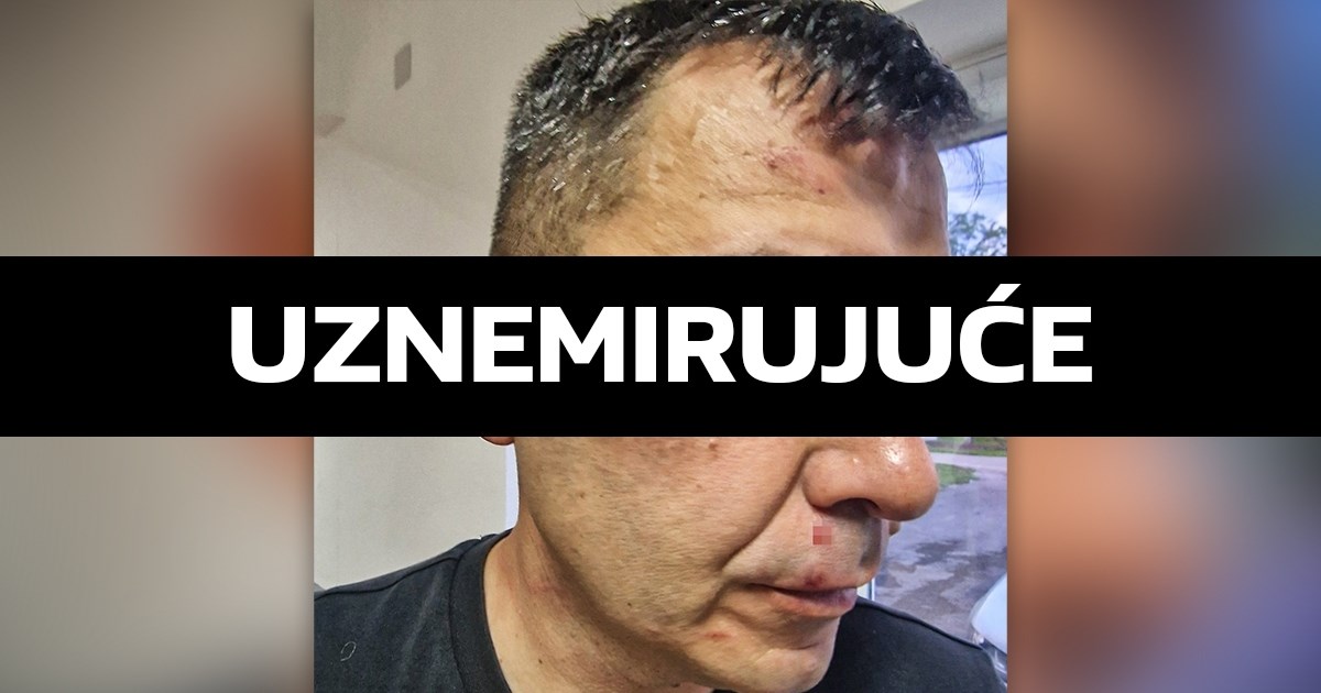 Skandal u BiH. Predsjednik kluba sa sinom ušao u svlačionicu i pretukao suca