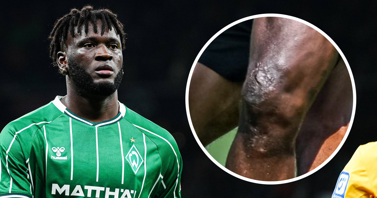 Bio je jedan od najboljih napadača u Europi. Sad završava karijeru u 26. godini?