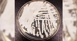 Smrtonosna gljivica otporna na više lijekova pronađena u prirodi