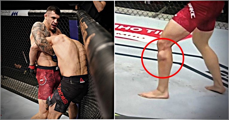 VIDEO Rakić se s ovakvom nogom borio u UFC-u. Fanovi tvrde da je pokraden