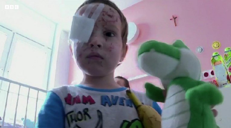 Majka i sinovi (5) iz Ukrajine oslijepili nakon eksplozije. Spasio ih poljski doktor