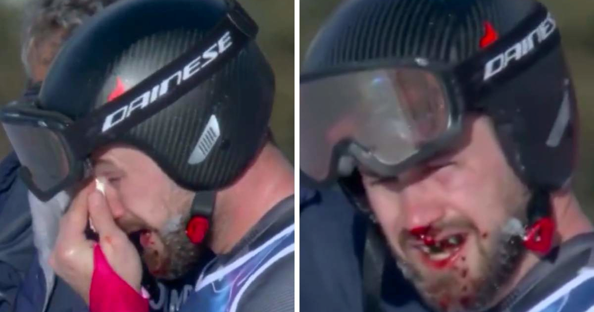 VIDEO Jeziva ozljeda Austrijanca na ZOI. "Glupo je što sam vrata pogodio licem"