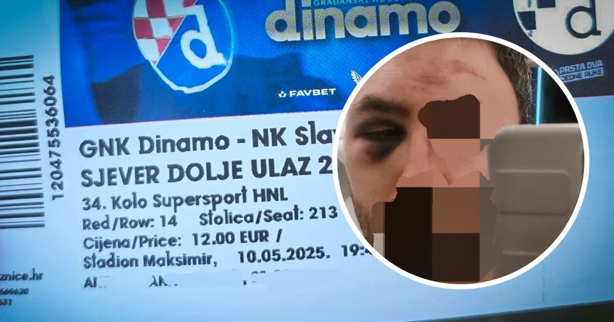 Talijani pretučeni na Dinamovom sjeveru demantiraju policiju: Nismo pjevali navijačke