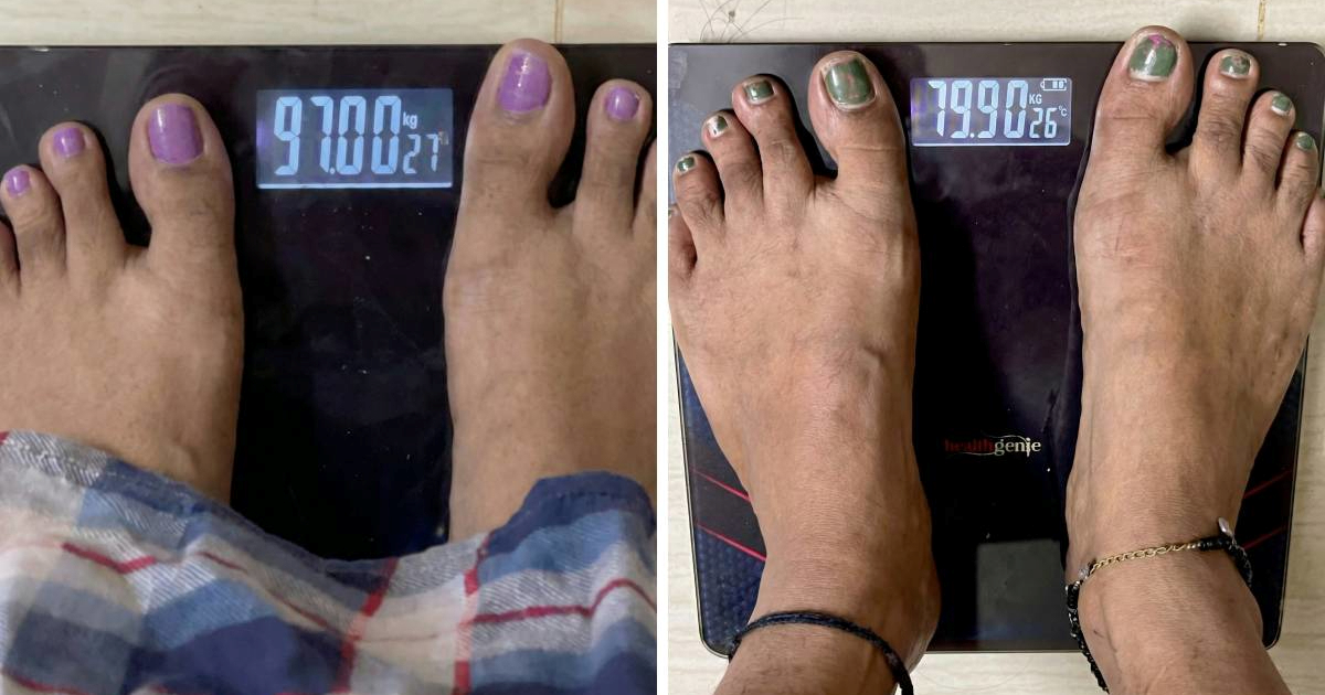 Žena je dva mjeseca jela jedan obrok dnevno. Dijetetičarka: "To ima niz nuspojava"