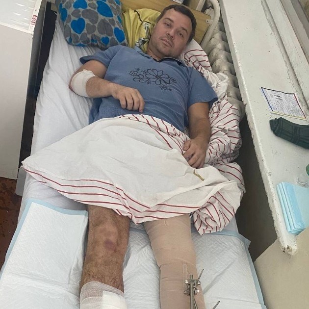 Ukrajinski plivački prvak teško stradao u ratu u Ukrajini. Pogodio ga je ruski dron