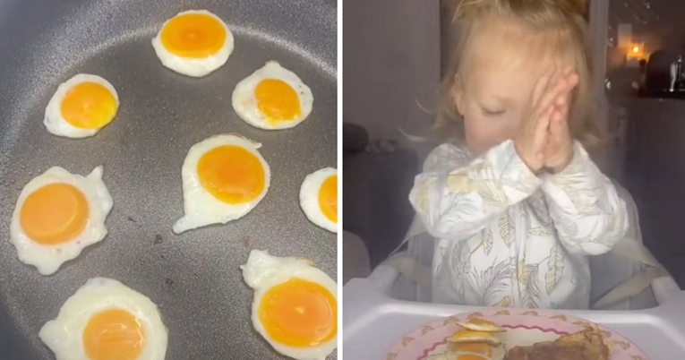Mama otkrila kako djeci radi minijaturna jaja na oko, stručnjaci kažu da je to opasno
