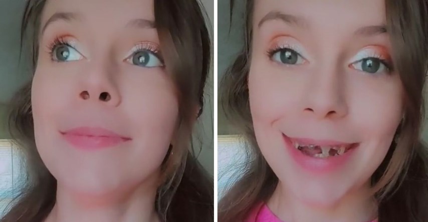24-godišnjakinja ostala bez gotovo svih zuba jer si nije mogla priuštiti stomatologa