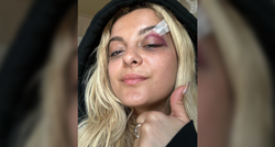 Javila se pjevačica koja je pogođena mobitelom u glavu na koncertu: Dobro sam