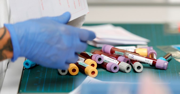 U Njemačkoj počelo testiranje potencijalnog cjepiva na ljudima
