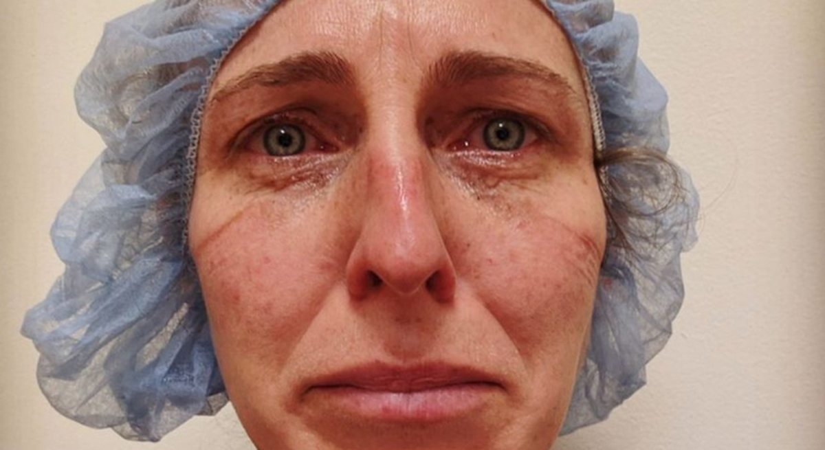 Ispovijest sestre kojoj je pacijent umro na rukama: Tri sam se noći borila za njega