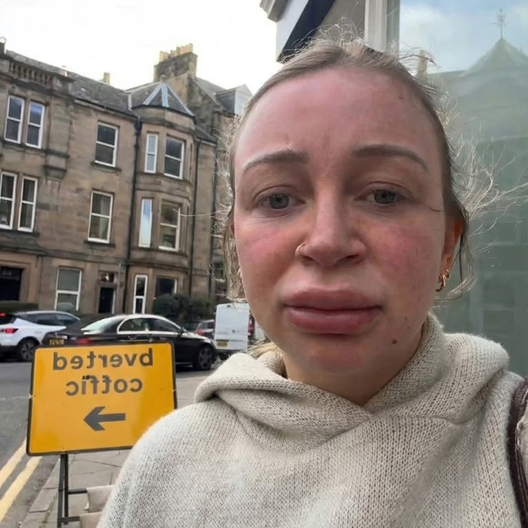 Otopila filere u usnama pa nasmijala mnoge: "Ovako sam išla po dijete u vrtić"