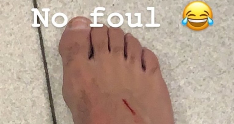 Pjanić objavio fotografiju posjekotine na stopalu: "Nije prekršaj"