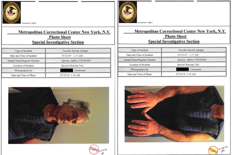 Objavljene fotografije nakon Epsteinova prvog pokušaja samoubojstva u zatvoru