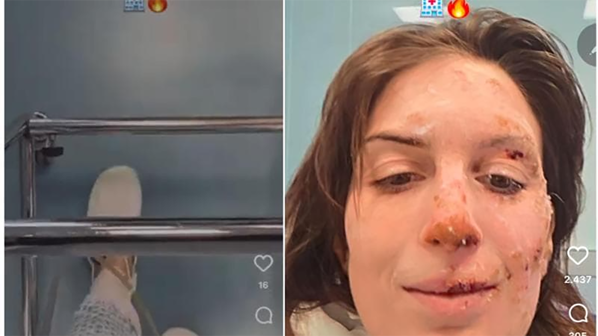 Talijanka preživjela požar u Švicarskoj objavila story: "Ne znam kako sam se spasila"