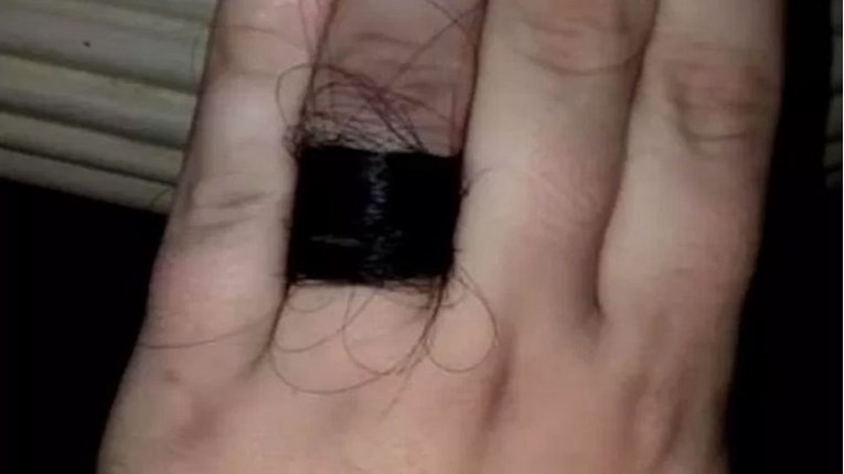 Dečko ju zaprosio prstenom od vlastite kose, ljude začudila njezina reakcija