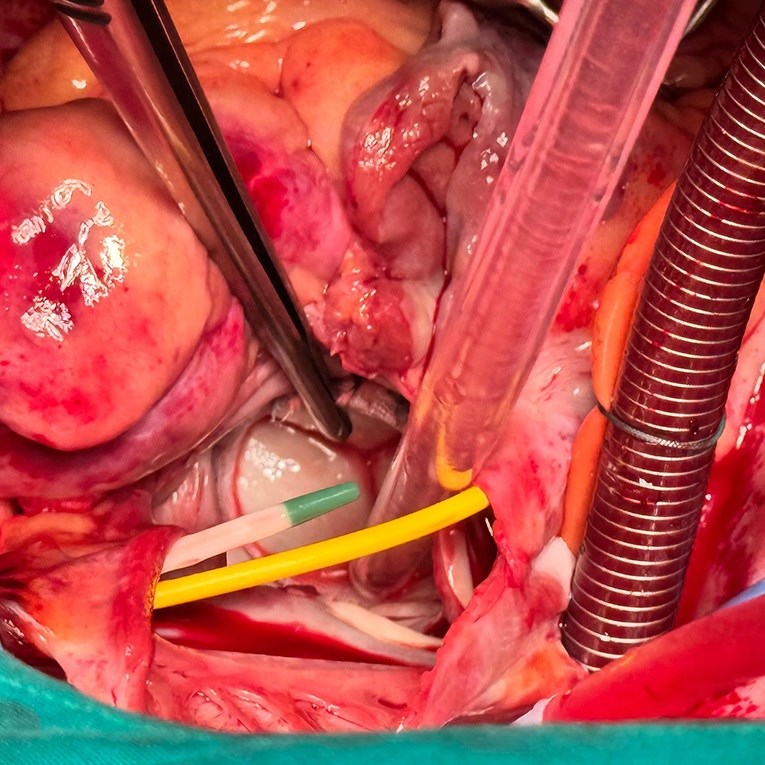 Ugradnja najnovijeg biološkog zaliska