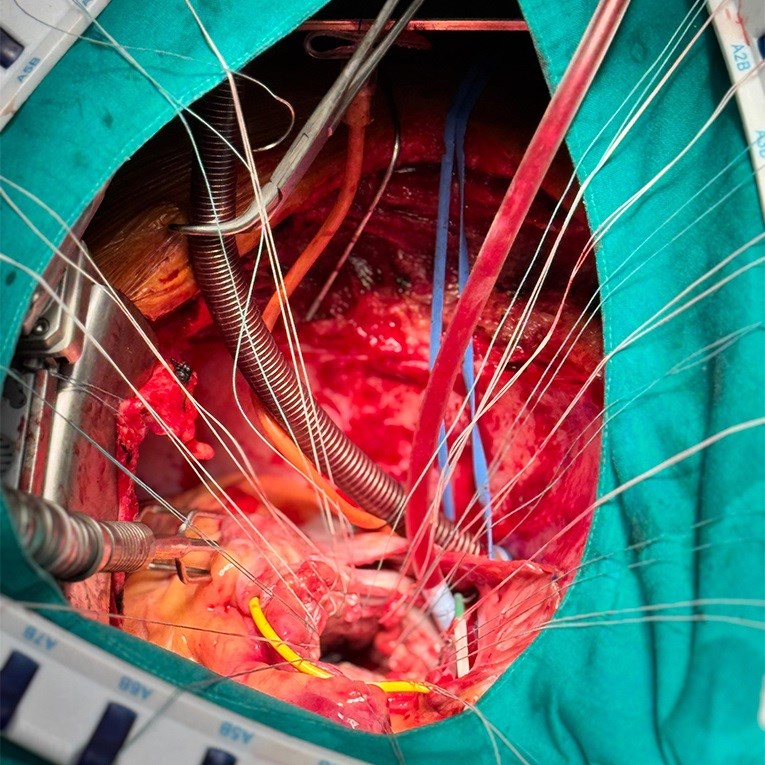 Ugradnja najnovijeg biološkog zaliska