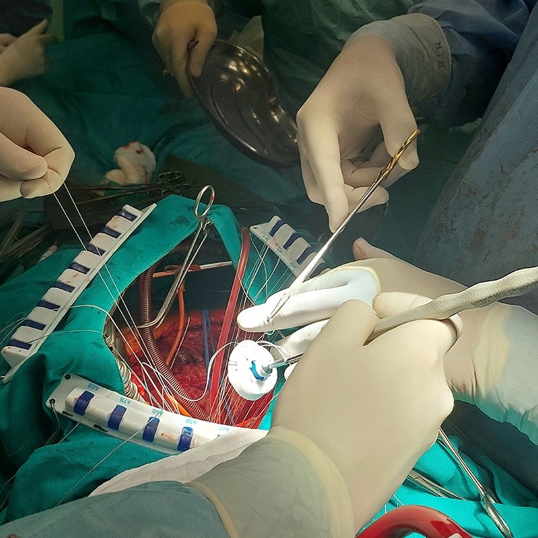 Ugradnja najnovijeg biološkog zaliska