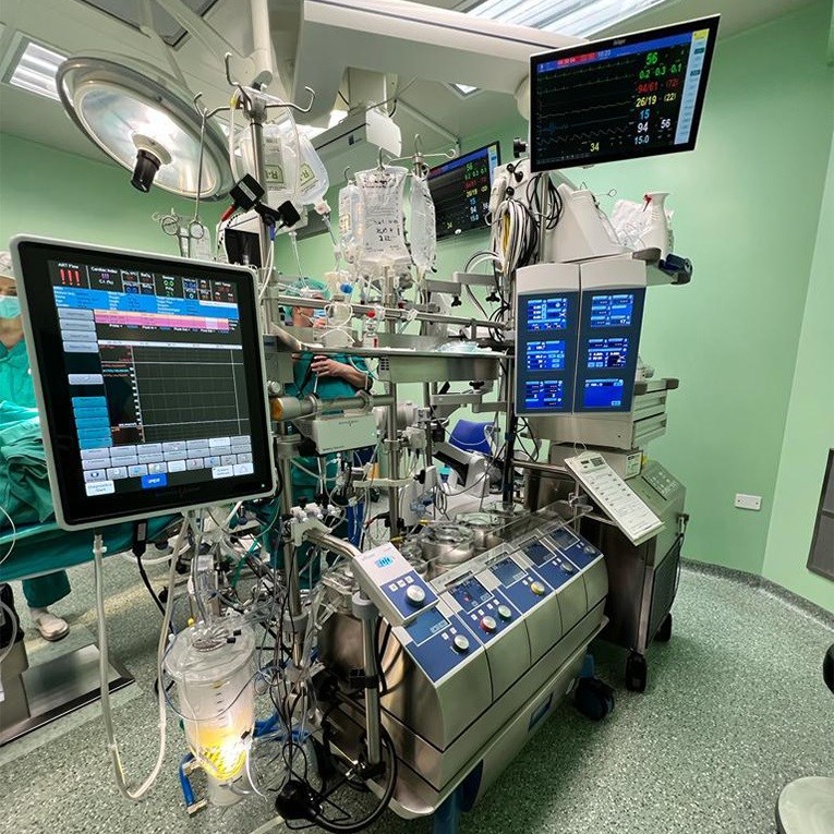 EKC uređaj koji je pratio rad srca i pluća tijekom zamijene zaliska