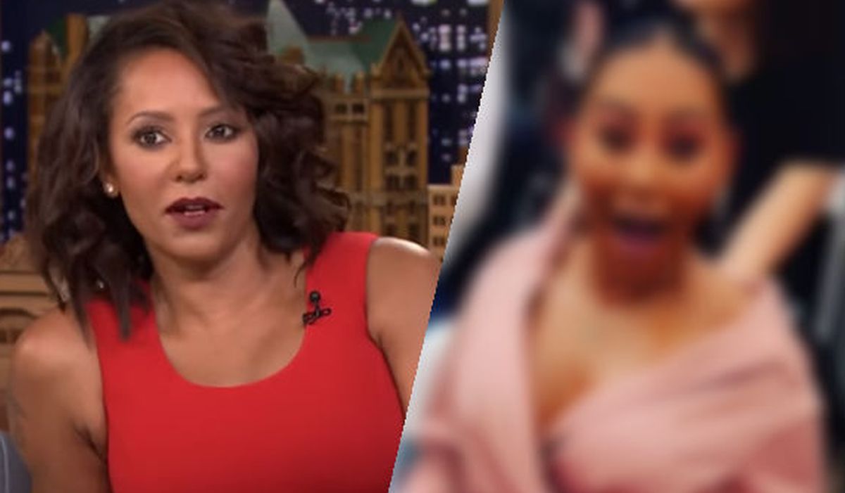 Nakon tretmana od 33.000 kuna, Mel B iznenadila fanove: "Što ti je s licem?"