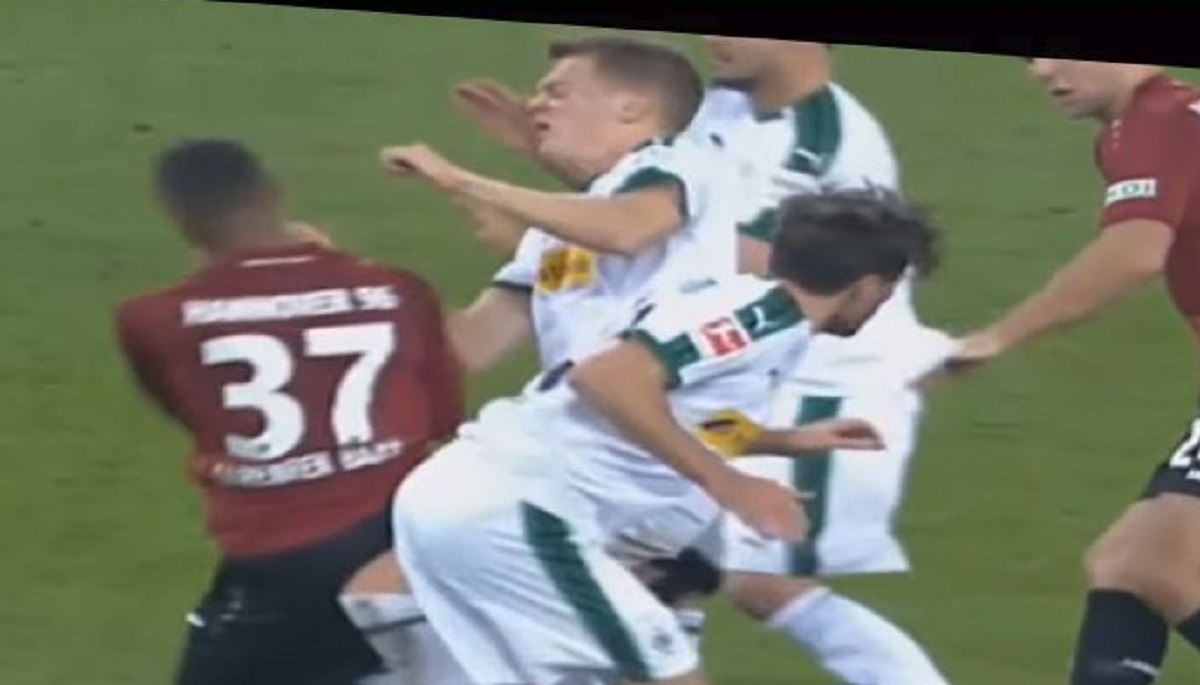 Stravična ozljeda reprezentativca Njemačke: Slomio očnu šupljinu i vilicu