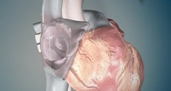 Revolucionarni zahvat u Rijeci: Izravno u srce ugradili najmanji pacemaker