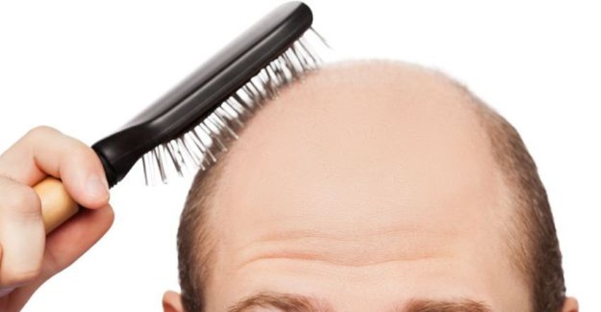Neprijatelji muške kose: Stručnjaci otkrili što ne smijete raditi ako ne želite oćelaviti