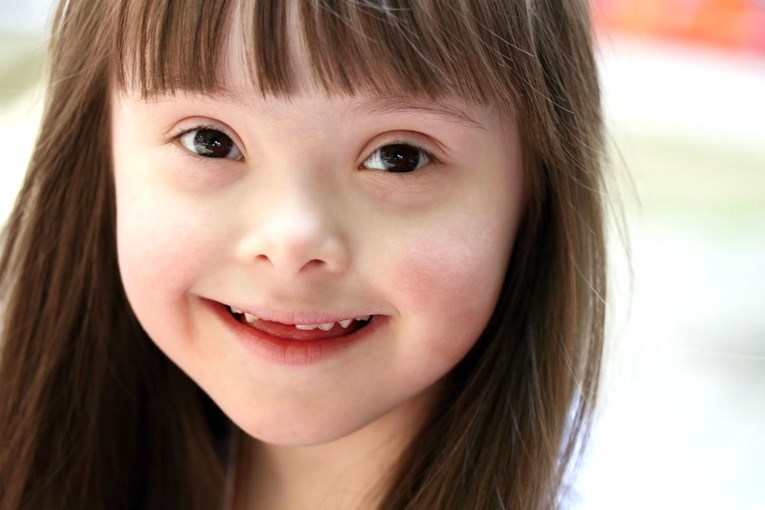 Sutra baš svi možete pomoći barem jednom djetetu sa sindromom Down!