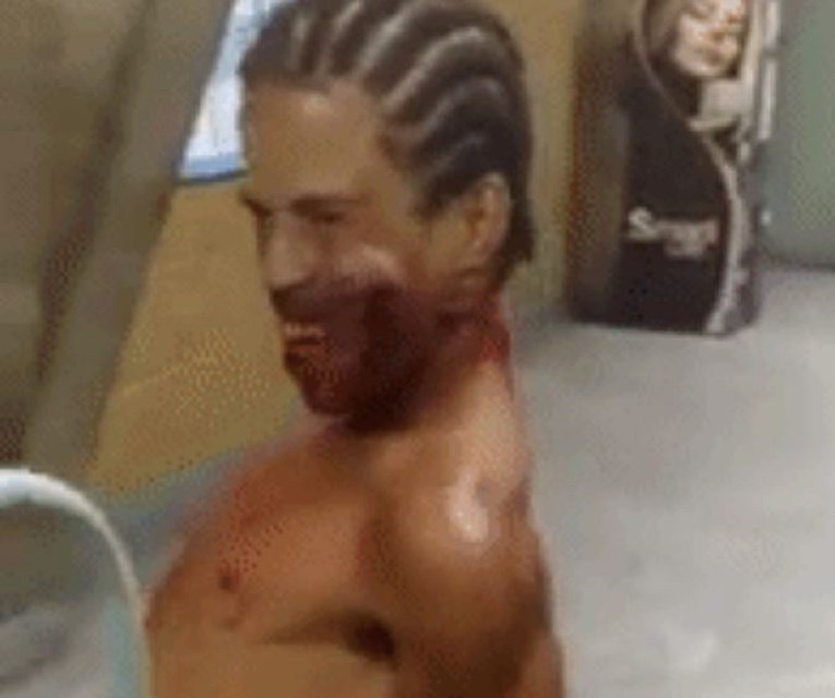 VIDEO Nakon što je upucan u lice, "opsjednuti" tip krvav lutao hodnicima po bolnici i zazivao Sotonu