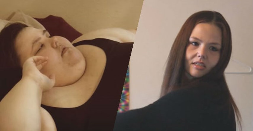 VIDEO Smršavila je čak 243 kilograma, a sad je na rubu da postane anoreksičarka