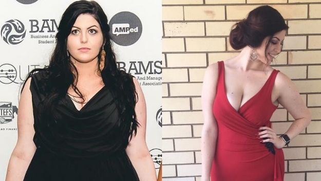 Djevojka izgubila 45 kilograma u godinu dana zahvaljujući ovoj napravi