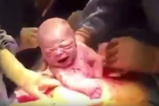 VIDEO Morate vidjeti ovaj emocionalni video carskog reza kojeg je uplakana mama snimila sama