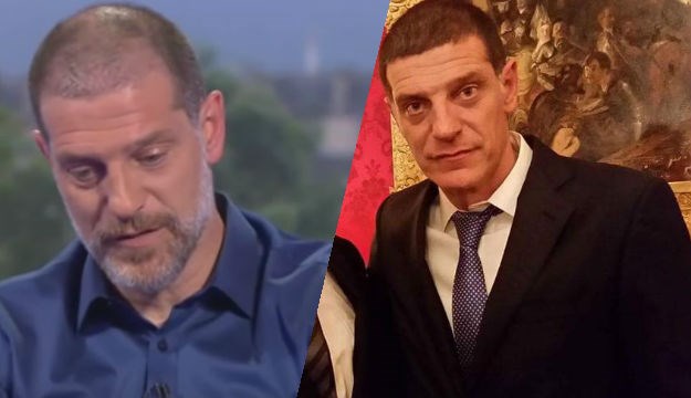 Slaven Bilić presadio kosu?