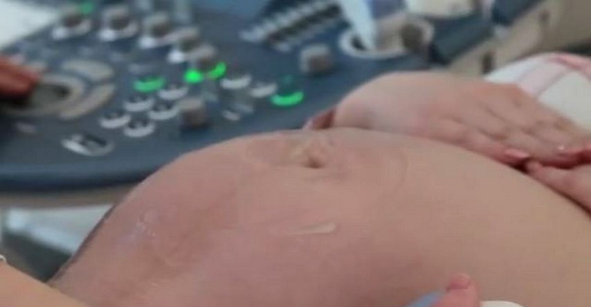 Rusi rade 3D print bebe iz utrobe kako bi ih mame mogle vidjeti i prije rođenja