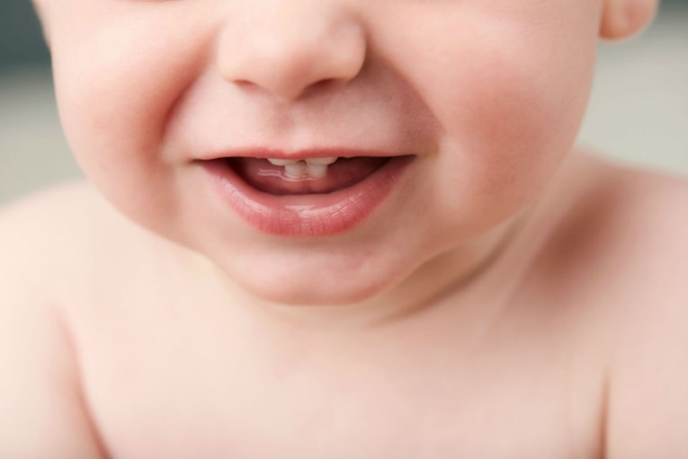 Pomozite bebi kod izbijanja prvih zubića