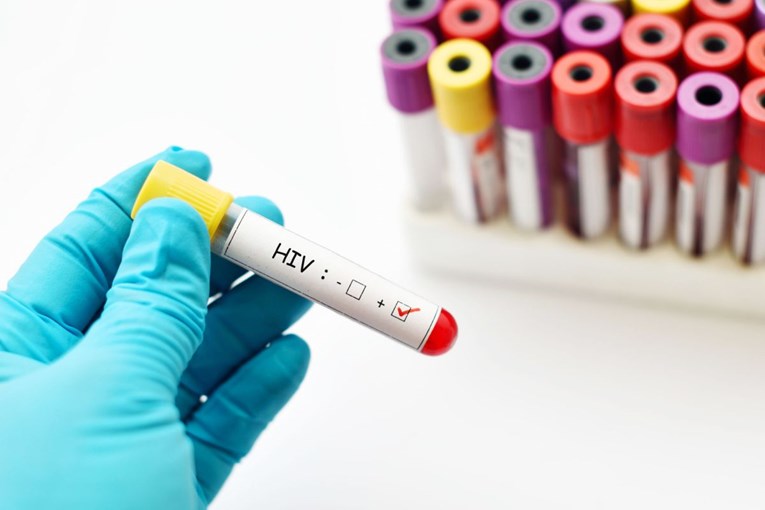 U europskim zemljama raste broj zaraženih HIV-om, virus često otkriju tek kad je prekasno