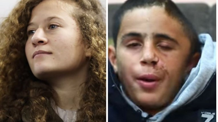 Nakon plavokose palestinske tinejdžerke, Izraelci uhapsili njenog rođaka kojeg su upucali u glavu