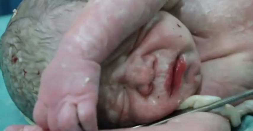 Pogledajte kako su liječnici u Siriji uspjeli spasiti bebin život