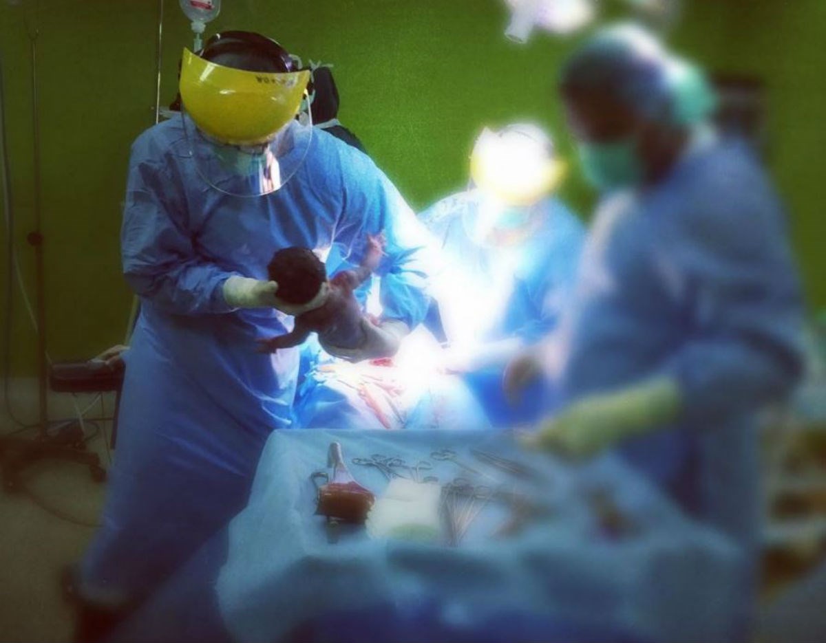 Bebe rođene carskim rezom trebalo bi dobro premazati  vaginalnim brisevima