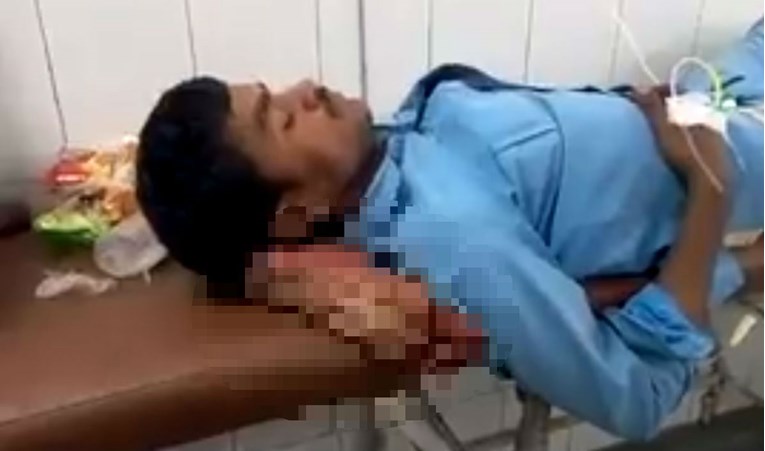 UZNEMIRUJUĆA FOTOGRAFIJA Umjesto jastuka u bolnici u Indiji pod glavu dobio svoju odsječenu nogu