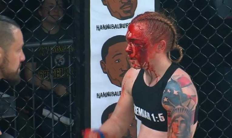 UZNEMIRUJUĆI VIDEO Pogledajte krvavi nokaut u ženskom MMA-u