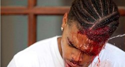 UZNEMIRUJUĆA SNIMKA Neonacisti u Charlottesvilleu brutalno pretukli mladog Afroamerikanca