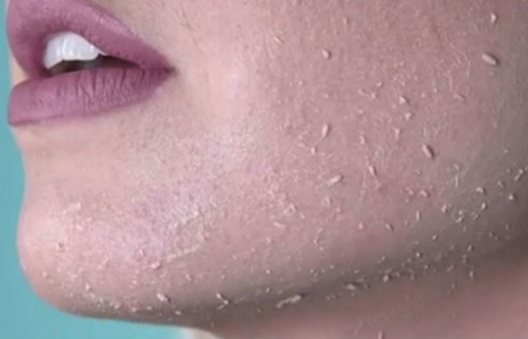 Ovaj korejski piling će vas prvo šokirati, a zatim oduševiti