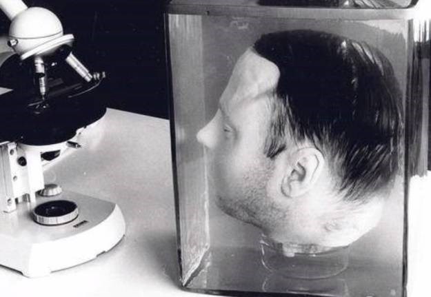 Glava njemačkog serijskog ubojice spaljena nakon 90 godina čuvanja u formalinu