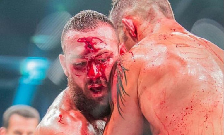 Prekrvavo za MMA: Liječnik prekinuo krvoproliće u Bellatorovom kavezu